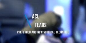 ACL Tears - Preferred and New Surgical Technique