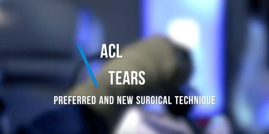 ACL Tears - Preferred and New Surgical Technique 7 ACL Tears - Preferred and New Surgical Technique