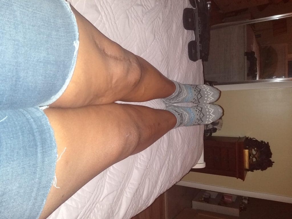 Knock Knee Valerie Bridges